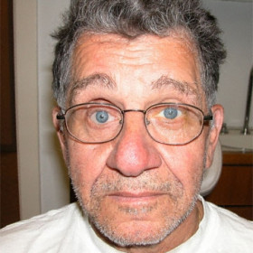 Man with glasses