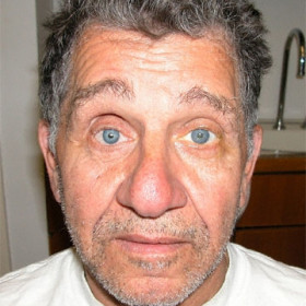 Man without glasses