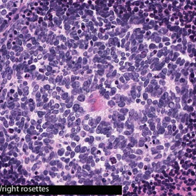 Pathology Slides