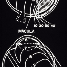 The relative radiation distribution of proton versus plaque radiation