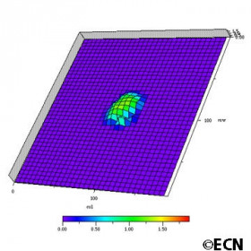 3D ultrasound generated topographic map