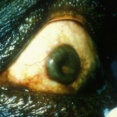 Post-hemorrhagic chocolate cyst