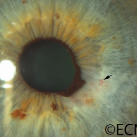 Intrinsic vascularity