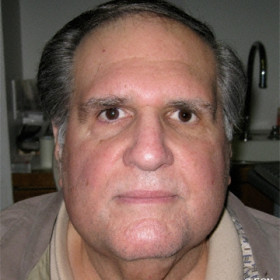 Excellent cosmetic result