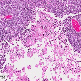 Retinoblastoma cells