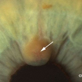 Intrinsic vascularity