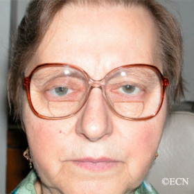 Lady with glasses II