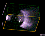 3D Ultrasound Image