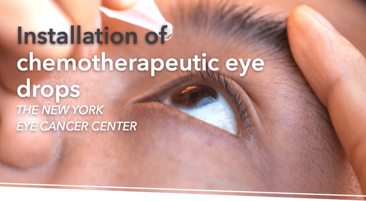 NYECC’s HowTo for Chemotherapy Eye Drops » New York Eye Cancer Center